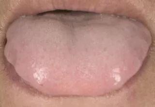 做艾灸喝红糖水好吗,用生姜和红糖怎么做艾灸