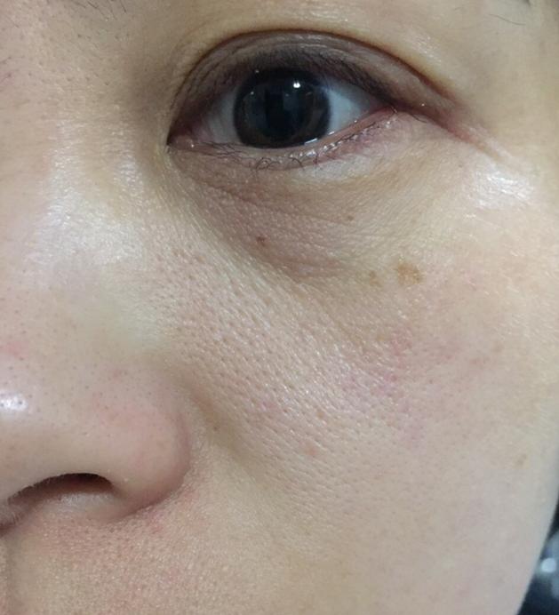 朵嘉浓敏感肌肤修复,朵嘉浓收缩毛孔