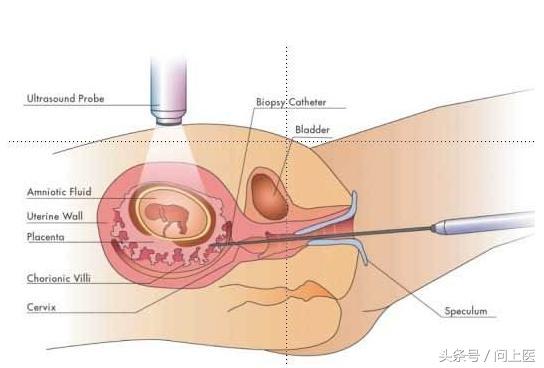 生男生女的谣言有哪些,到底生男生女要不要听谣言