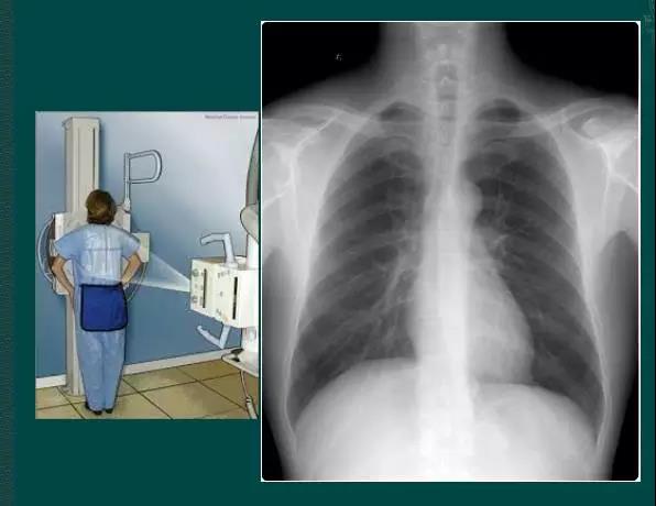 读完该文，让你学会如何看胸片