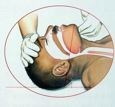 突发心脏病有什么急救措施,突发心脏病应该怎么急救