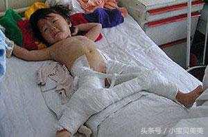 《小儿夹腿综合征》爸爸妈妈关注了！