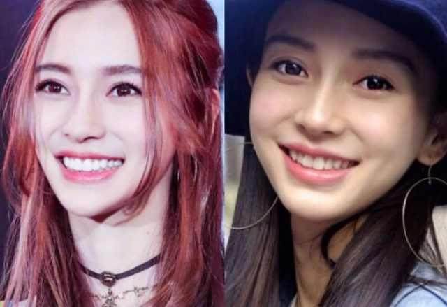 杨颖整牙前和整牙后的区别,baby杨颖整牙