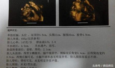 做四维彩超有什么关注事项,做四维彩超的关注事项是什么