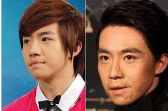 俞灏明烧伤前后对比照任家萱,俞灏明烧伤前后对比照锦绣未央