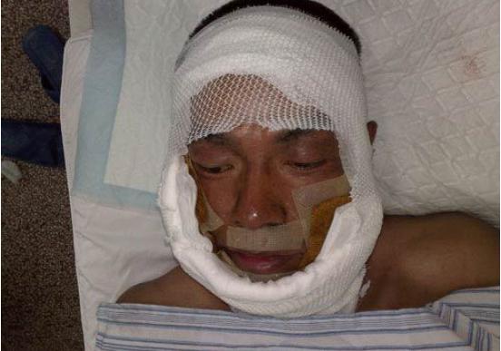 俞灏明烧伤前后对比照任家萱,俞灏明烧伤前后对比照锦绣未央