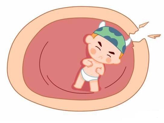 孕妇胎膜早破会影响胎儿发育吗,胎膜早破怎么预防