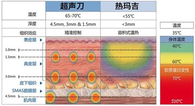 超声刀和热玛吉区别适合人群,热玛吉和超声刀该怎么选
