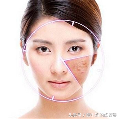 痘痘怎么长出来视频,痘痘怎么快速发出脓包