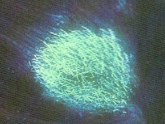 人得了猫癣如何预防猫癣扩散,猫癣在治疗的过程中传染吗