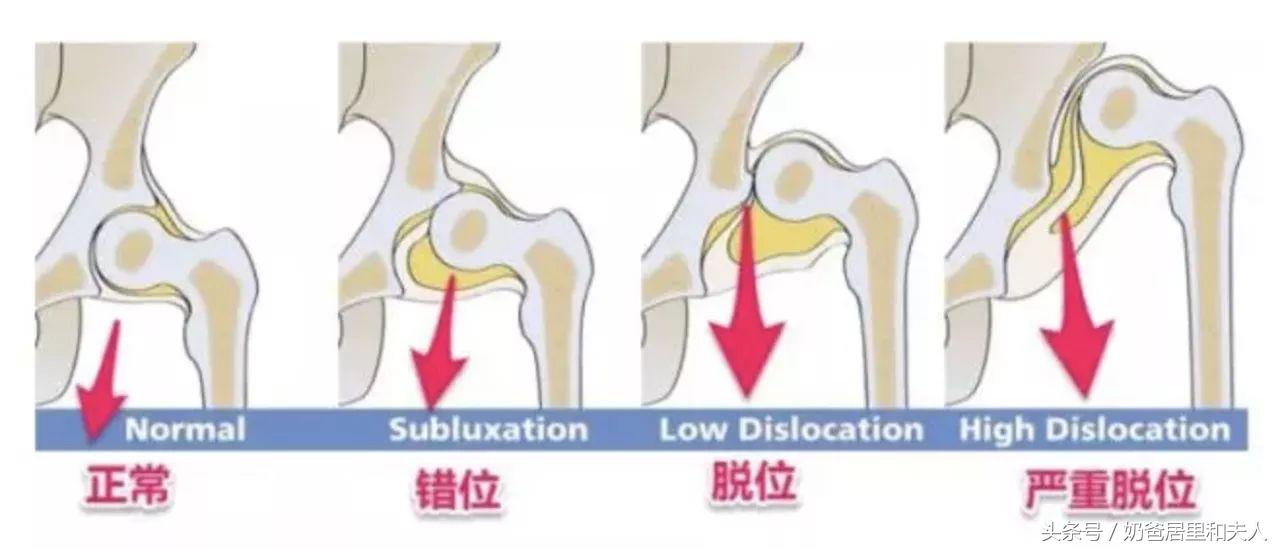 腿纹不对称的宝宝不会爬吗,腿纹不对称家长千万别忽视
