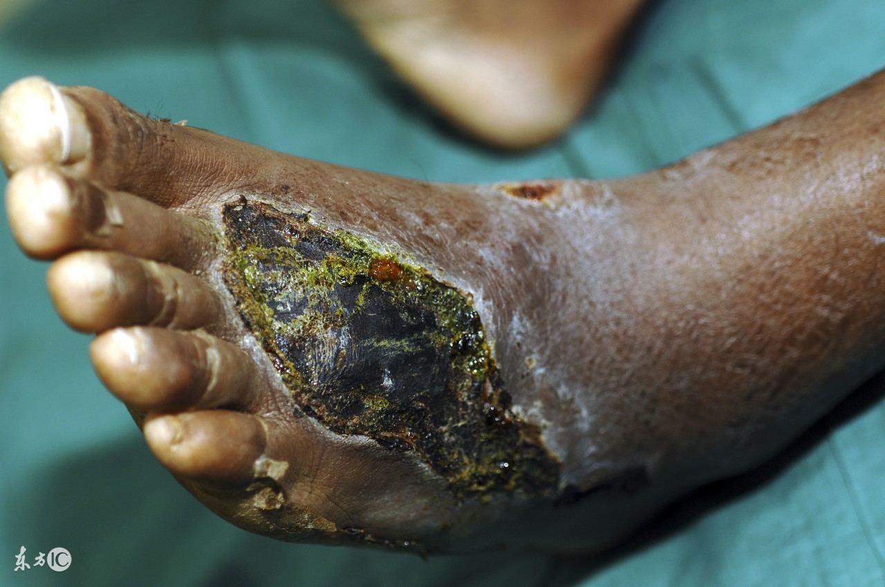 北京高新戒毒中心,北京高新医院戒毒治疗管用吗