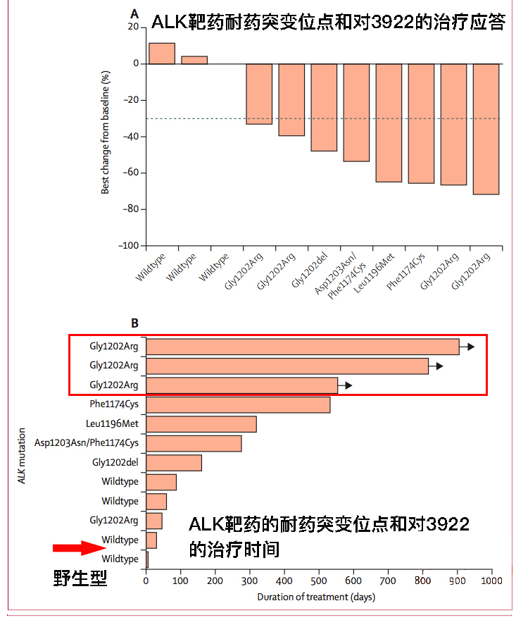 柳叶刀治胃癌效果,劳拉替尼肺癌第三代靶向药