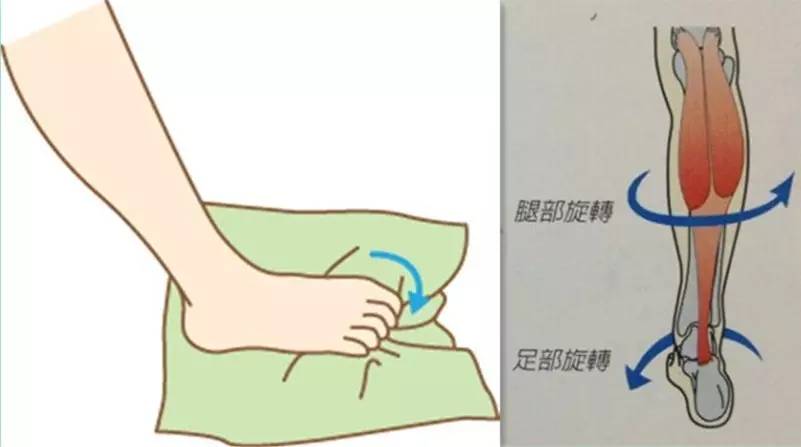 如何让扁平足拥有足弓,扁平足跑起来有足弓