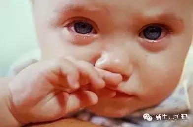 宝宝感冒鼻涕颜色变化的过程,怎么根据鼻涕的颜色判断感冒类型