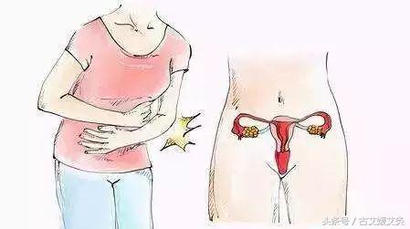子宫肌瘤谁割谁后悔？西医无良策，艾灸有活路！
