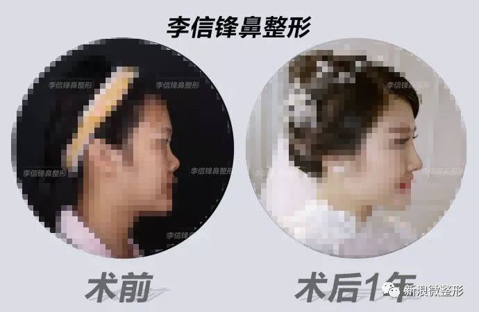 又到周四案例时间！快来看看这期有没有你想做的项目~