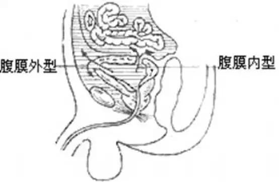 腹腔脏器炎症ct可以查出来吗,腹腔脏器ct表现图像