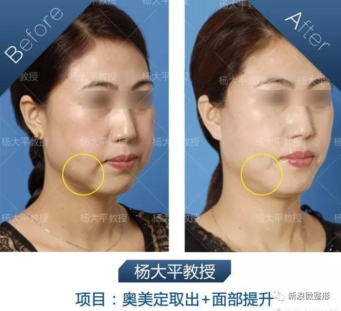 又到周四案例时间！快来看看这期有没有你想做的项目~