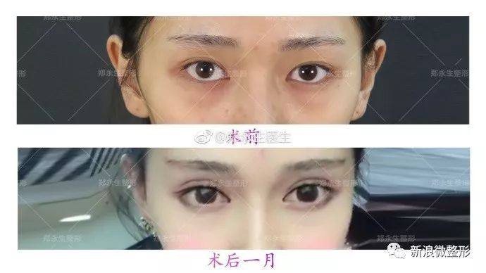 又到周四案例时间！快来看看这期有没有你想做的项目~