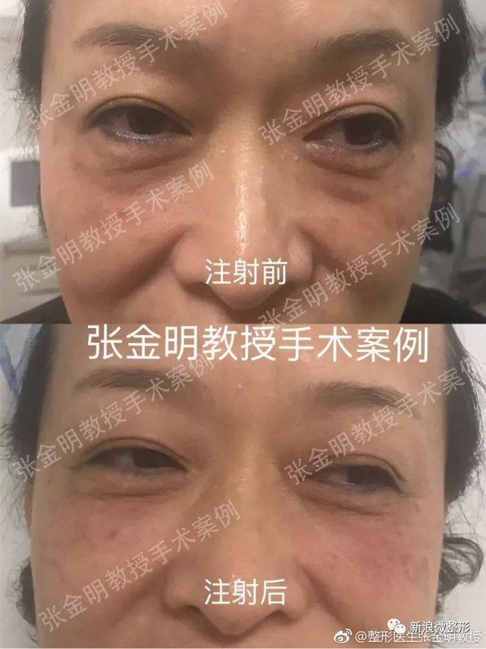 又到周四案例时间！快来看看这期有没有你想做的项目~