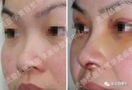 又到周四案例时间！快来看看这期有没有你想做的项目~