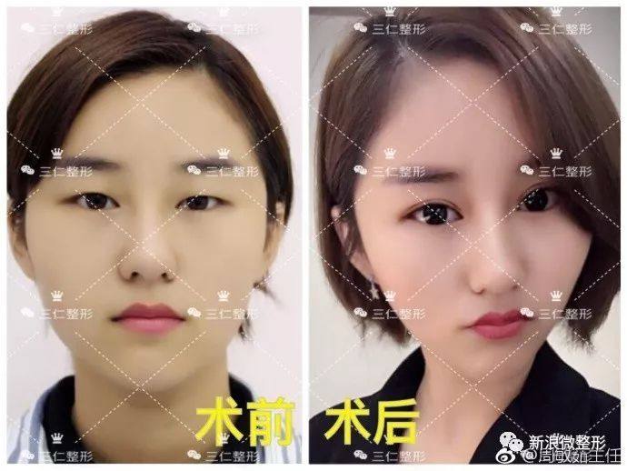 又到周四案例时间！快来看看这期有没有你想做的项目~