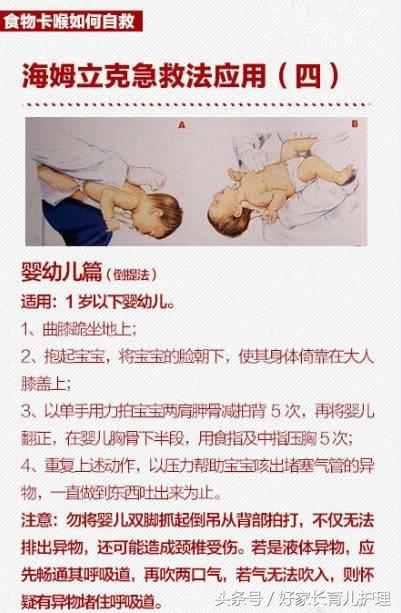 桂圆卡住喉咙致死,被桂圆卡喉咙急救法