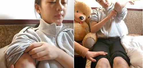 张默打童瑶事件立案了吗,张默暴打童瑶事件后续