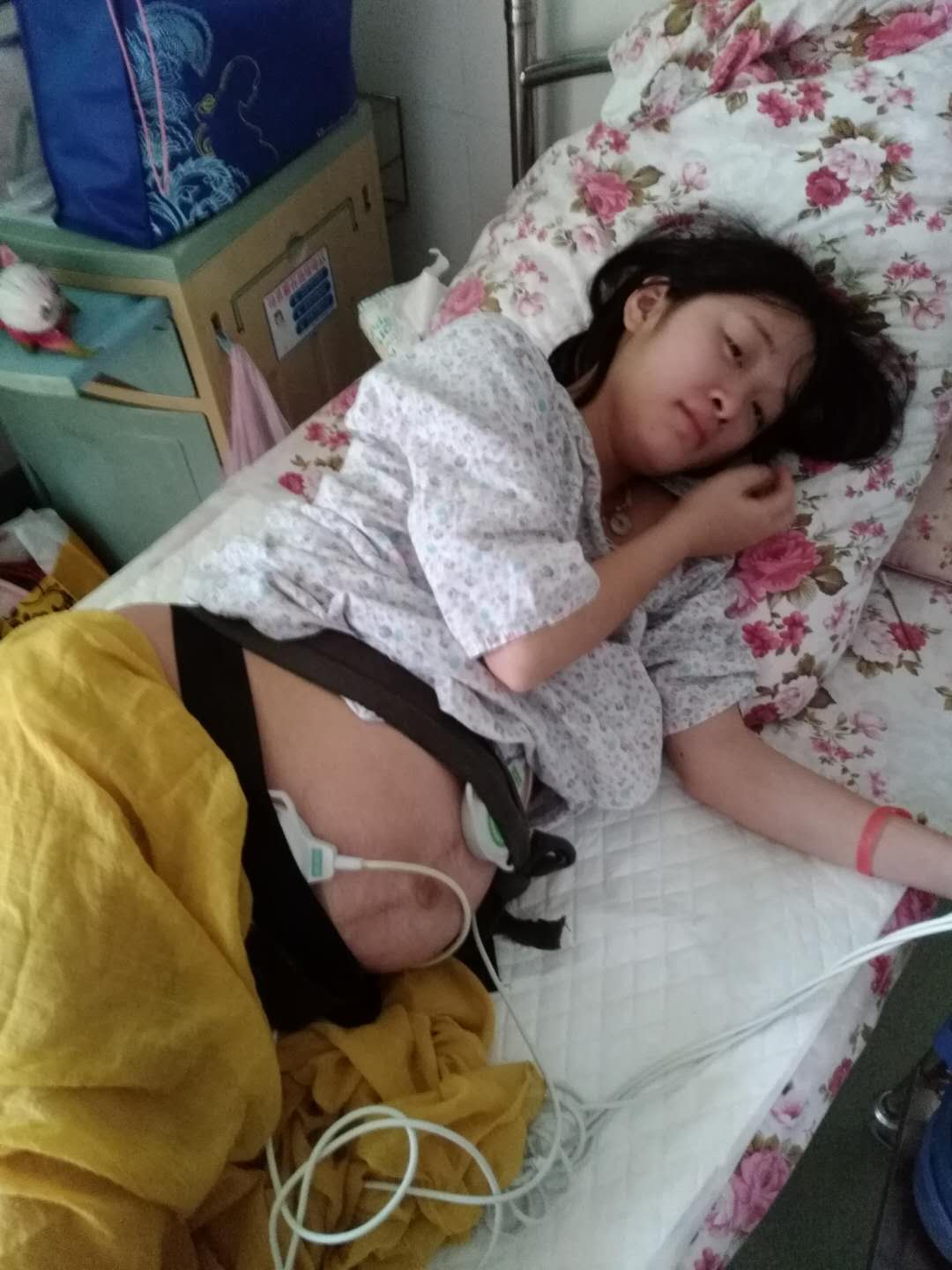 新爸新妈要知道妇产科经常说的这几句暗语，不然现场会很尴尬