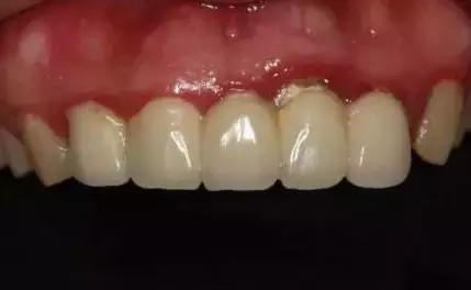 美容冠美白,一周快速脸部美白小妙招