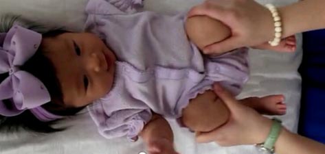 初生儿胀气肠绞痛怎么办,胀气了肠绞痛怎么缓解