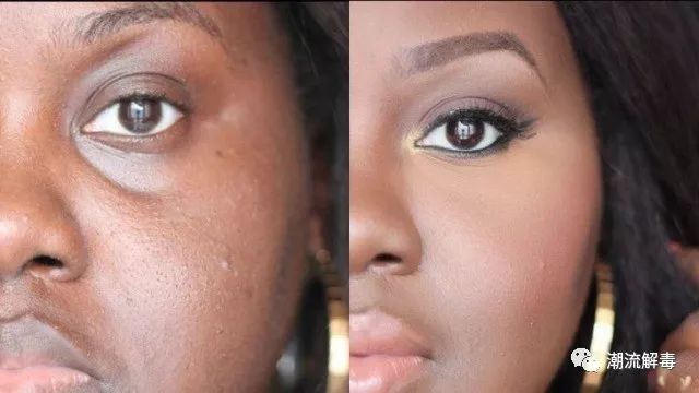 怎样让已经变老的眼睛恢复年轻,眼睛衰老什么方法可以消除皱纹