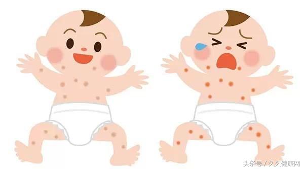 新生儿发烧皮疹,婴儿急疹发高烧了才出疹子吗