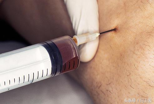 高中生膝盖疼痛的原因和解决方法,爬楼梯膝盖疼痛的原因和解决方法