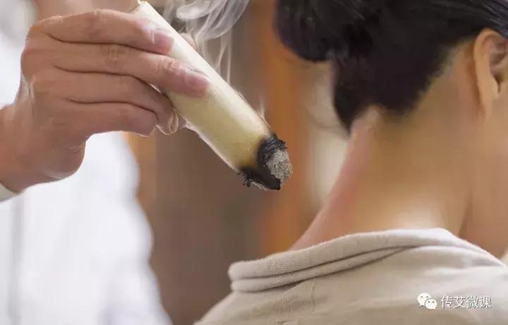 送你五千万,手把手教你学艾灸