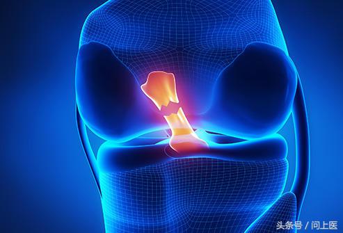 高中生膝盖疼痛的原因和解决方法,爬楼梯膝盖疼痛的原因和解决方法