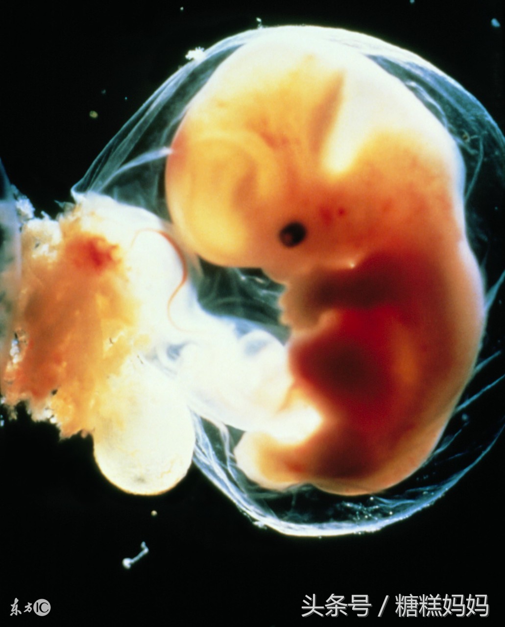 孕期须知：羊水破了是什么症状，有哪些关注事项