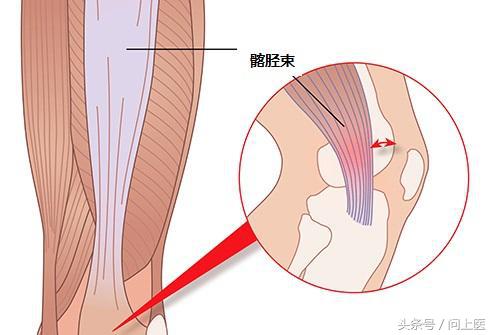 高中生膝盖疼痛的原因和解决方法,爬楼梯膝盖疼痛的原因和解决方法