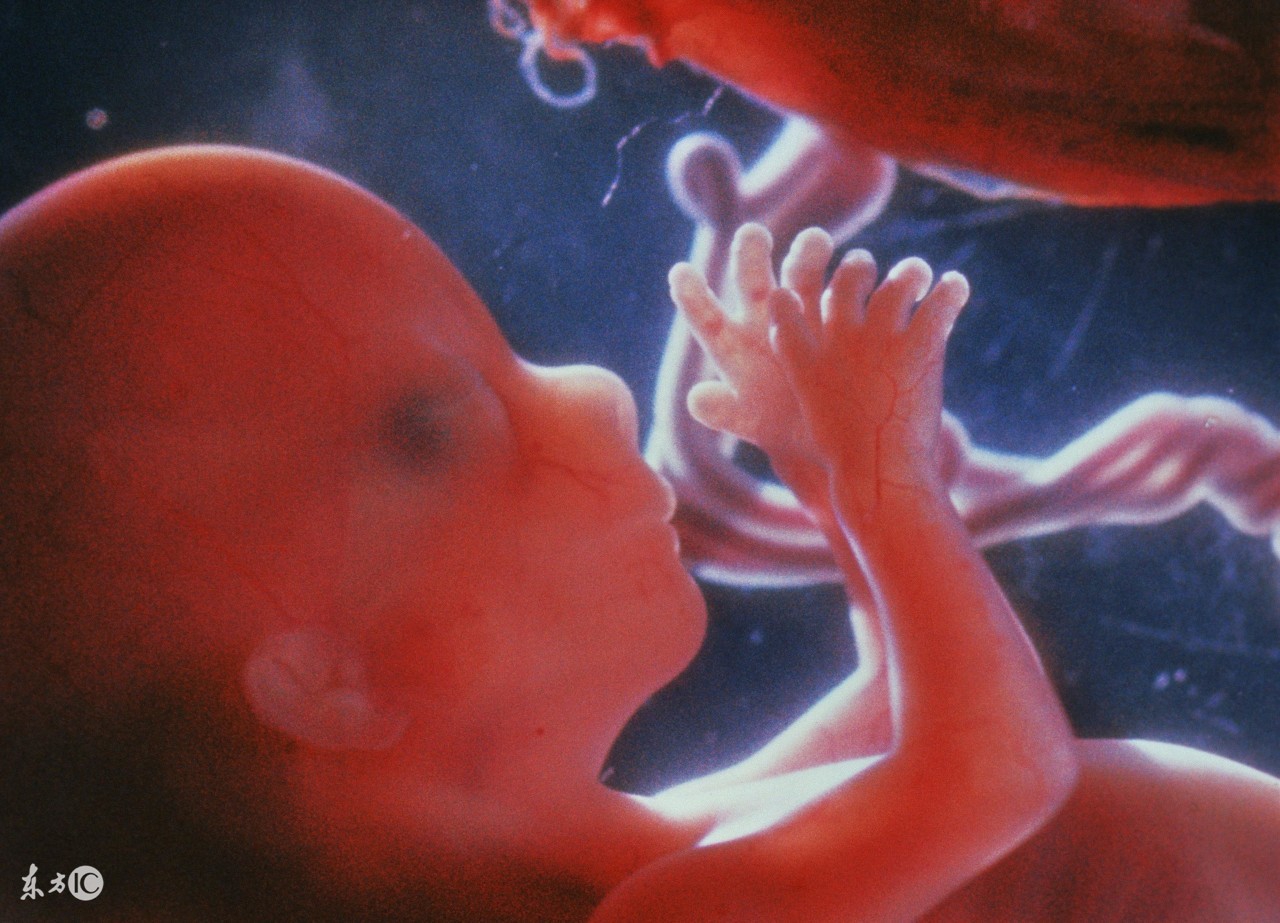 唐筛，无创DNA，羊水穿刺有什么区别？