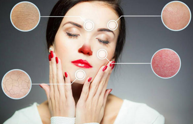 为啥你是西方的玫瑰却是东方的*疮痤**