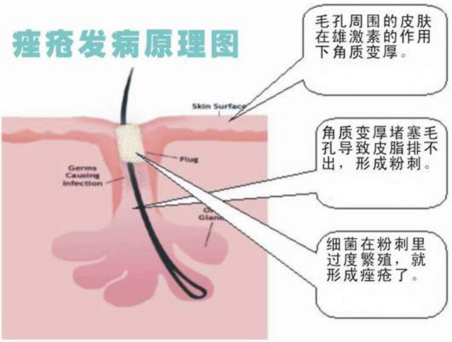 为啥你是西方的玫瑰却是东方的*疮痤**
