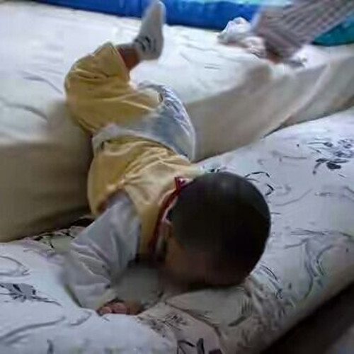 宝宝摔下床后脑淤血,孩子摔下床脑震荡表现