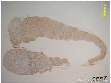 lncrna研究思路,如何研究lncrna的作用机制