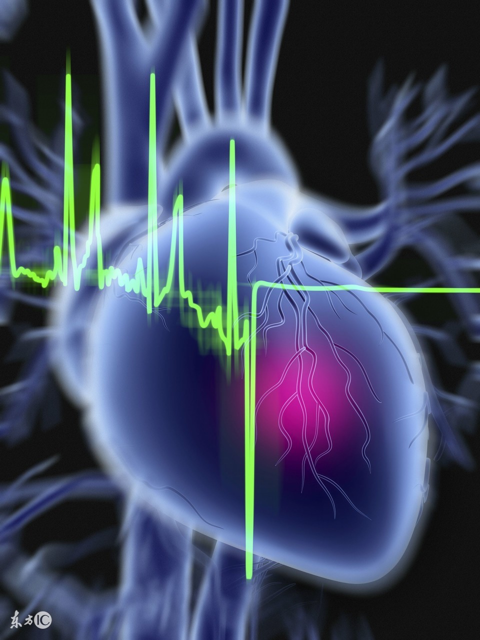 缓解心肌缺血最快的中成药,心肌缺血喝少量的酒可以缓解吗