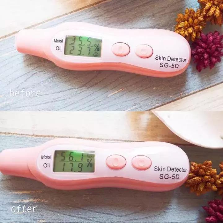 痘痘不长出来也不消怎么办,脸上的痘印持久不消