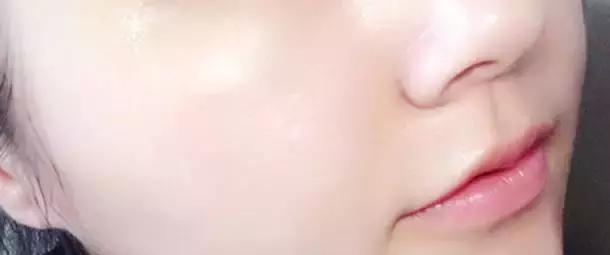 痘痘不长出来也不消怎么办,脸上的痘印持久不消