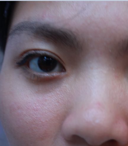 脸暗黄色没有光泽怎么办,脸部暗黄没有光泽度怎么调