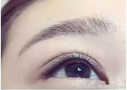 做了美瞳线双眼皮不见了,美瞳线做完1-7天肿胀的对比图