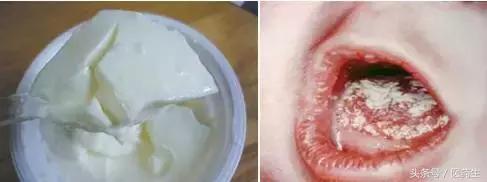 舌尖上的中医药论文,舌尖上的医疗